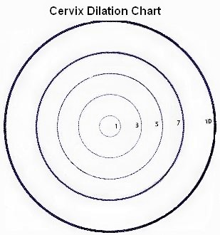 Cervical Dilation Chart