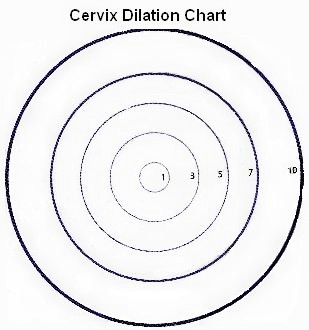 dilated cervix