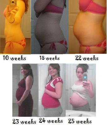 Pregnancy Photographs