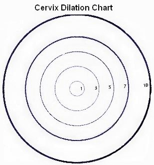 Labor Dilation Chart